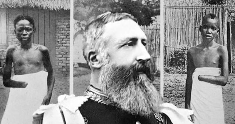 Leopold II and Congolese hands cut off