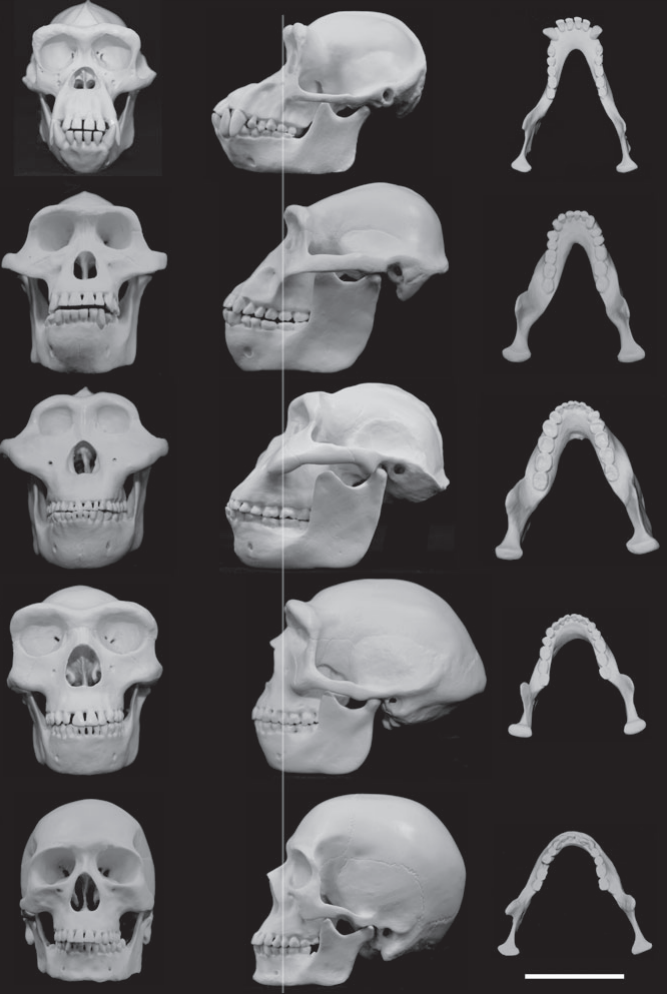 Protective Buttressing